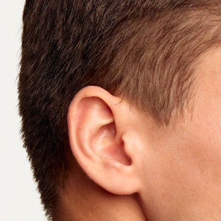 Depilación Láser Masculina en Patillas