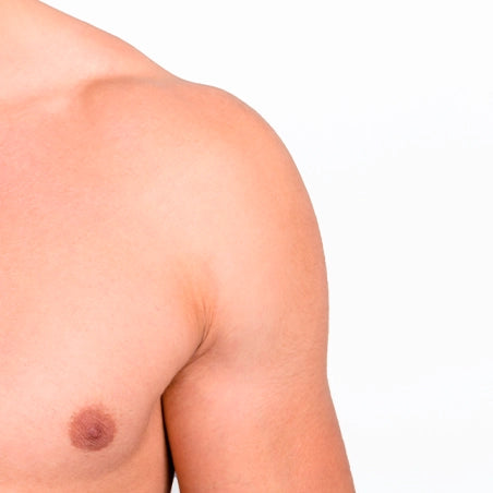 Depilación Láser Masculina en Hombros