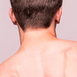 depilacion laser cuello posterior hombre