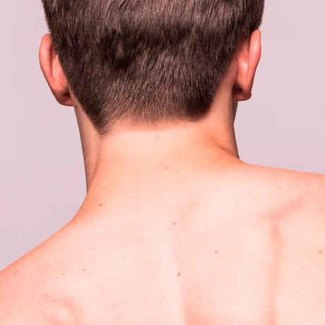 depilacion laser cuello posterior hombre